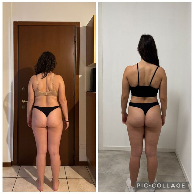 Confronto prima e dopo di una cliente: riduzione del grasso e maggiore tono di gambe e glutei