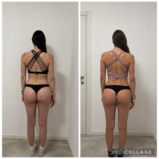 Confronto prima e dopo di una cliente, vista posteriore: glutei e schiena più tonici